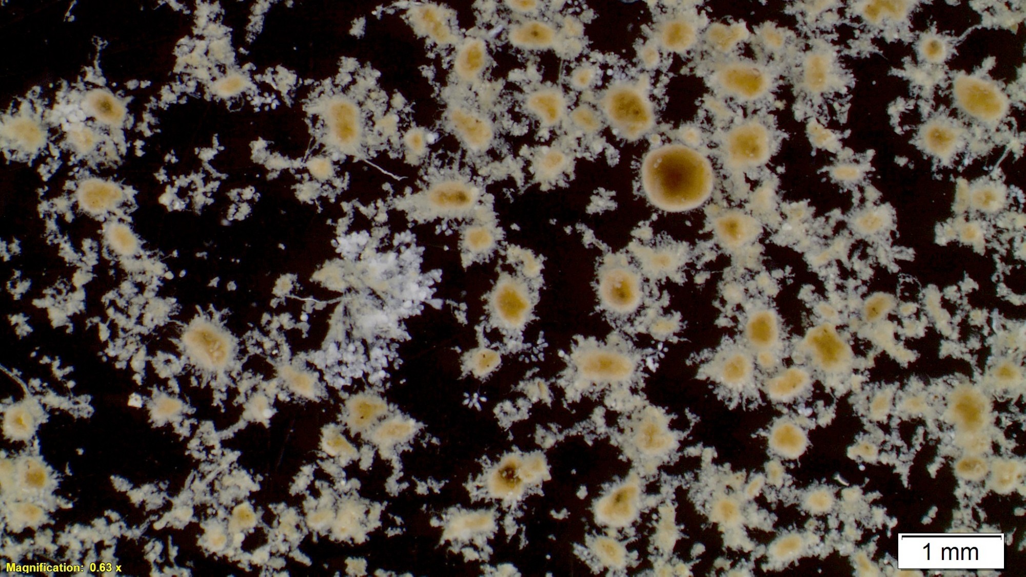 Belebtschlamm unter dem Mikroskop