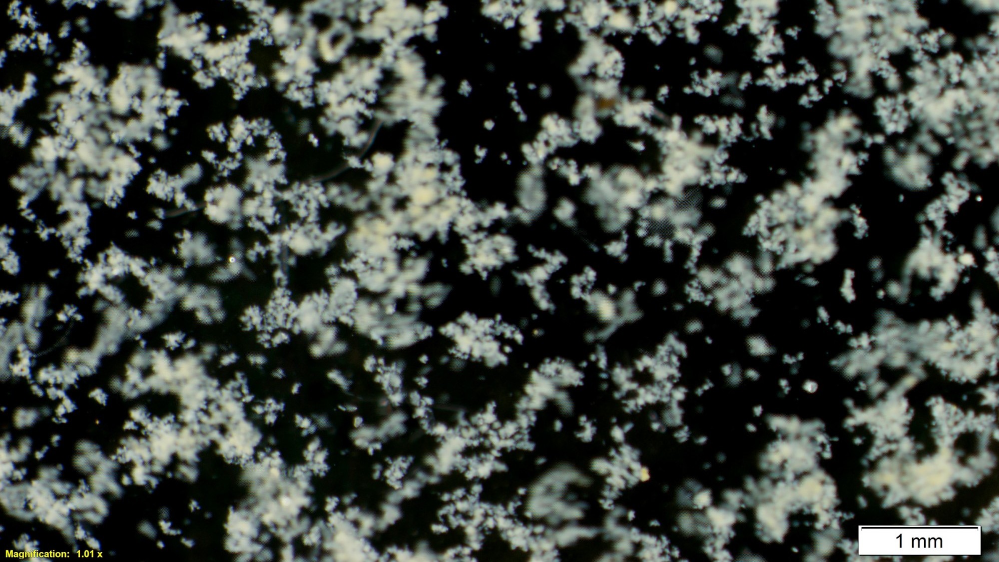 Belebtschlamm unter dem Mikroskop